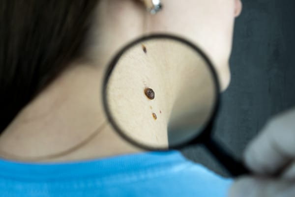 Photodynamic therapy is used in dermatology to treat pre-cancerous and cancerous skin lesions.